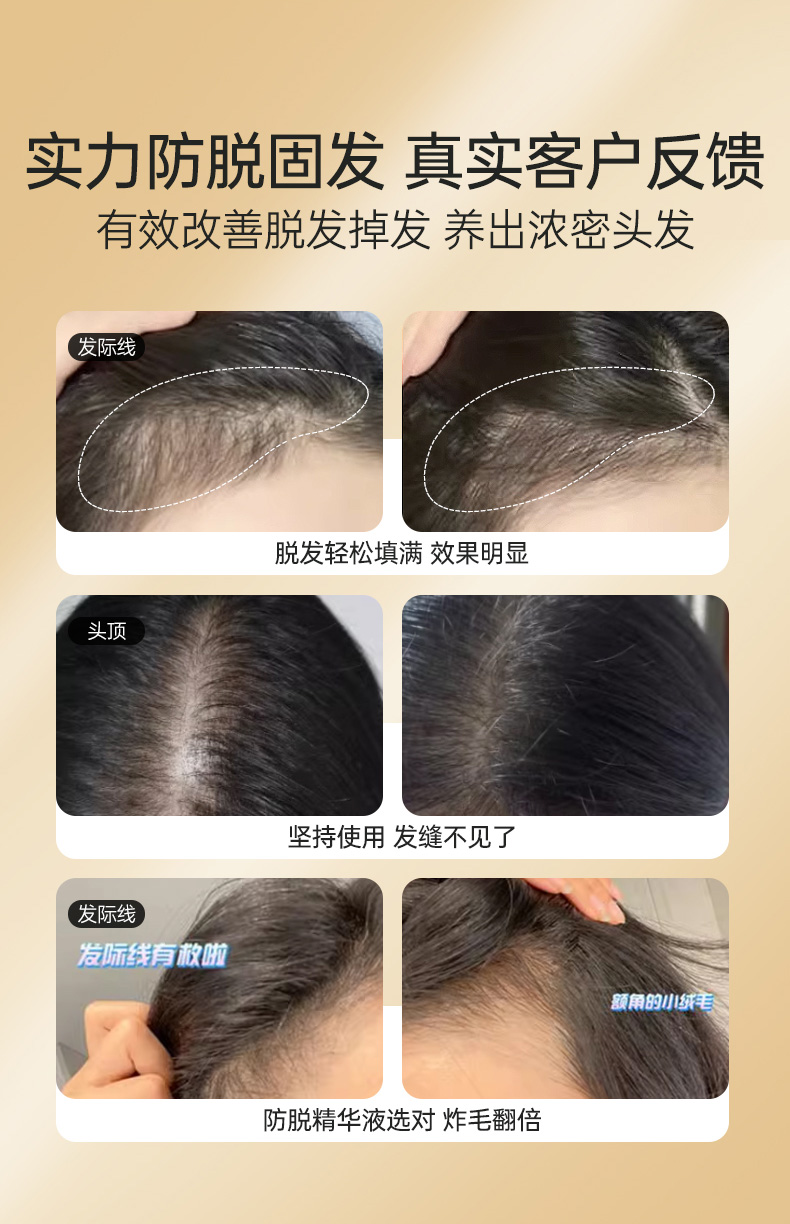 防脱精华液_02